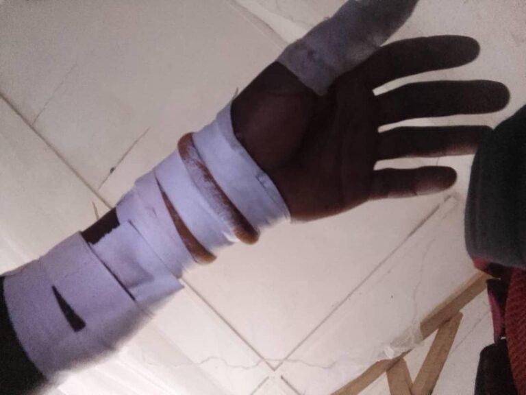 Ituri : un civil mutilé par des miliciens Chini ya Tuna à Bawanza, la société civile réclame des mesures