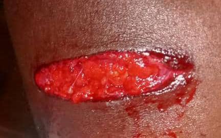 Kisangani : un prêtre blessé par balles dans une attaque armée près de Canal Orient 3 IMG 20250906 WA0004